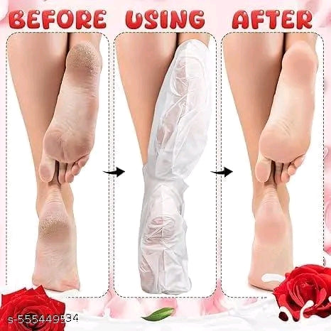 Exfoliating Foot Peel Mask – Removes Dead Skin & Softens Cracked Heels